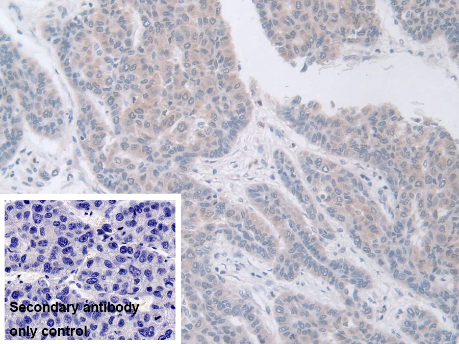 Polyclonal Antibody to Guanine Deaminase (GDA)