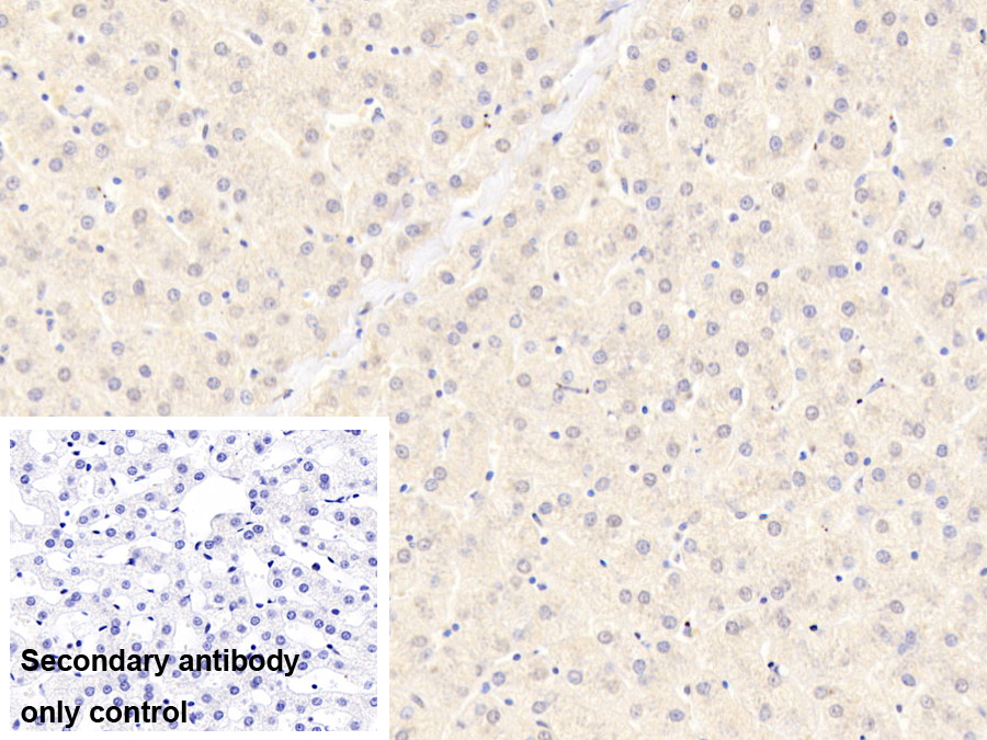 Polyclonal Antibody to Fructosamine-3-Kinase (FN3K)