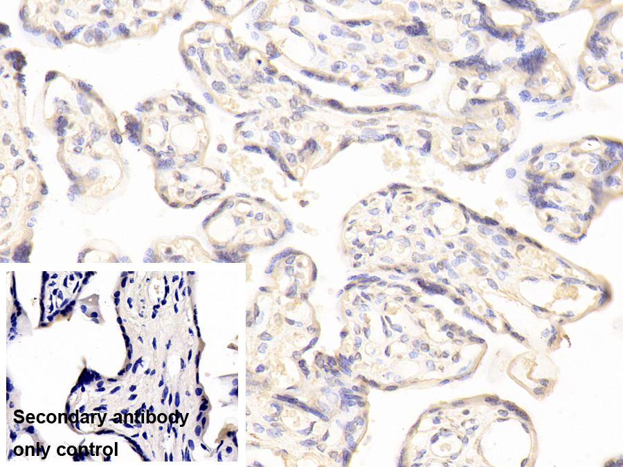 Polyclonal Antibody to Fructosamine-3-Kinase (FN3K)