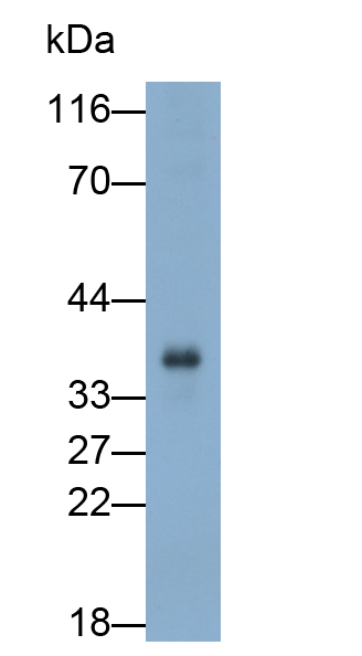 Polyclonal Antibody to Fructosamine-3-Kinase (FN3K)