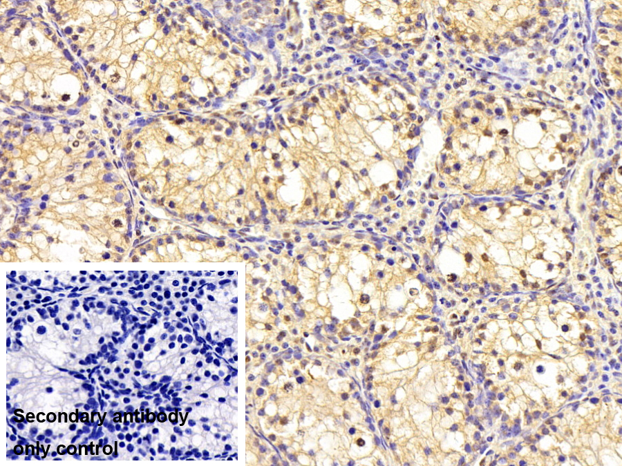 Polyclonal Antibody to Fragile X Mental Retardation 1 (FMR1)