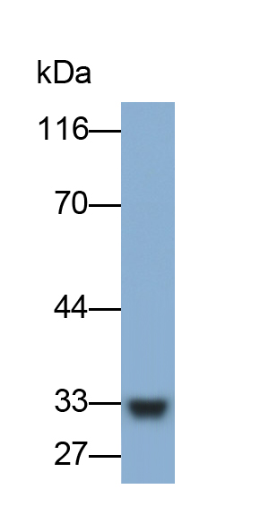 Polyclonal Antibody to Filaggrin (FLG)