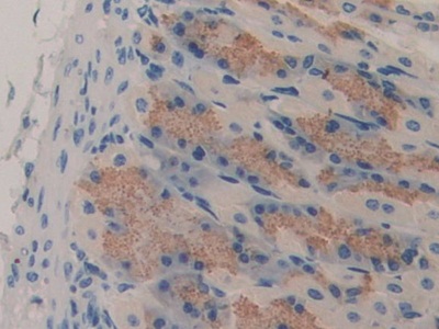 Polyclonal Antibody to Feline Sarcoma Oncogene (FES)