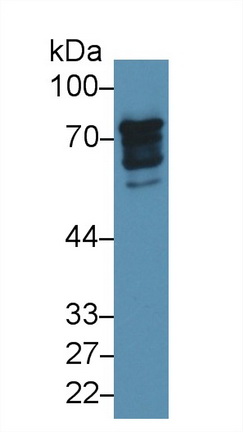 Polyclonal Antibody to Epsin 1 (EPN1)