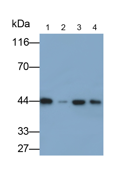 Polyclonal Antibody to Dolichyl Diphosphooligosaccharide Protein Glycosyltransferase (DDOST)