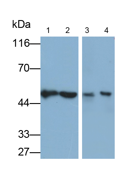 Polyclonal Antibody to Dolichyl Diphosphooligosaccharide Protein Glycosyltransferase (DDOST)