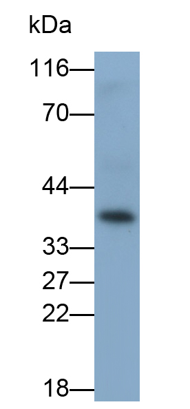Polyclonal Antibody to Coxsackie Virus And Adenovirus Receptor (CXADR)