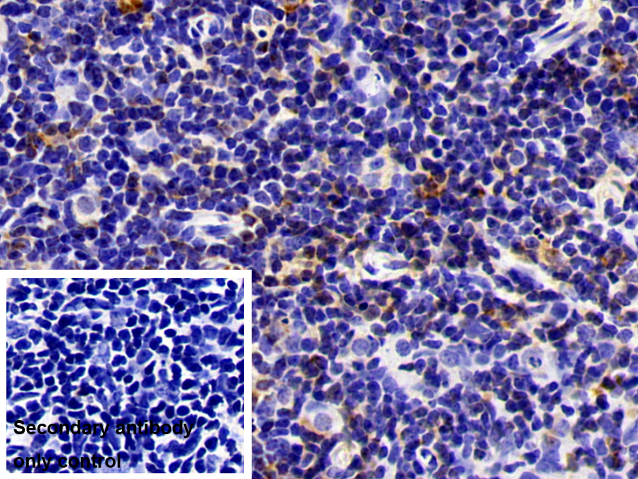 Polyclonal Antibody to Coactosin Like Protein 1 (COTL1)