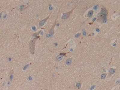 Polyclonal Antibody to Coronin 1A (CORO1A)