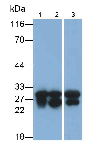 Polyclonal Antibody to Catechol-O-Methyltransferase (COMT)