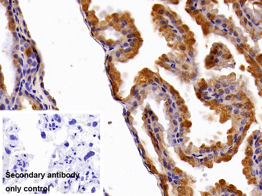 Polyclonal Antibody to Catechol-O-Methyltransferase (COMT)