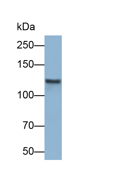 Polyclonal Antibody to Cartilage Intermediate Layer Protein 2 (CILP2)