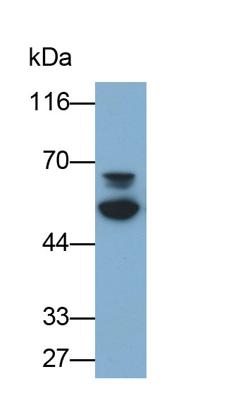 Polyclonal Antibody to Cystathionine Beta Synthase (CbS)