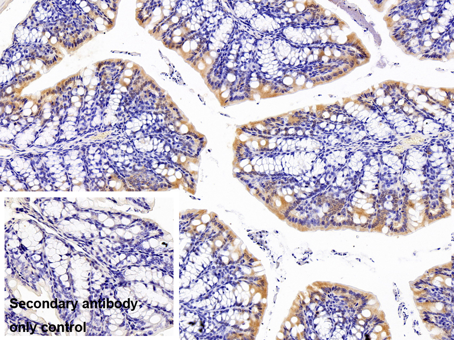 Polyclonal Antibody to Dishevelled, Dsh Homolog 1 (DVL1)