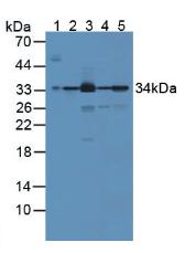 Polyclonal Antibody to Biliverdin Reductase A (BLVRA)