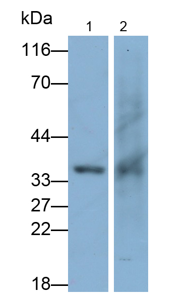 Polyclonal Antibody to Biliverdin Reductase A (BLVRA)