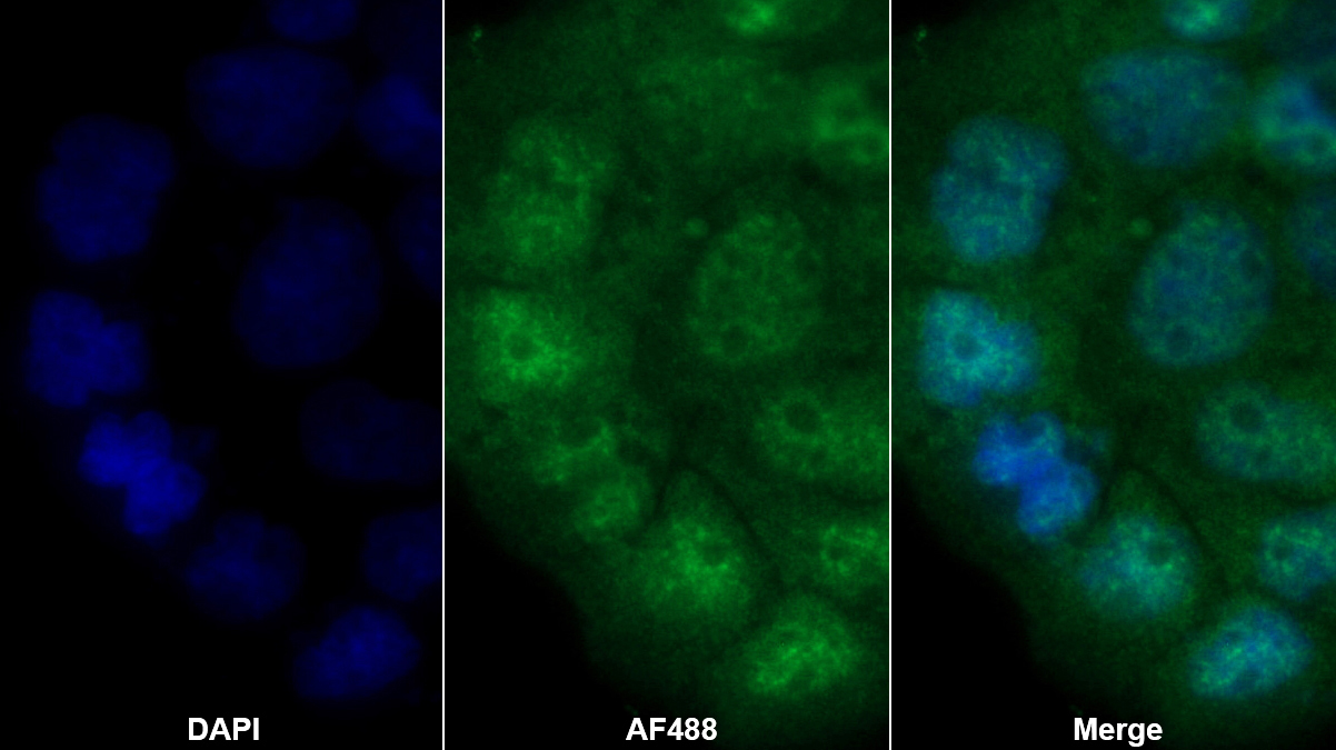 Polyclonal Antibody to Acidic Nuclear Phosphoprotein 32 Family, Member A (ANP32A)