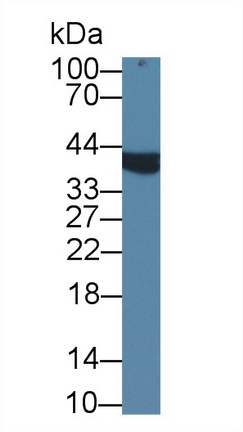 Polyclonal Antibody to Alpha-Methylacyl Coenzyme A Racemase (aMACR)