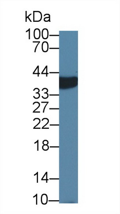 Polyclonal Antibody to Alpha-Methylacyl Coenzyme A Racemase (aMACR)