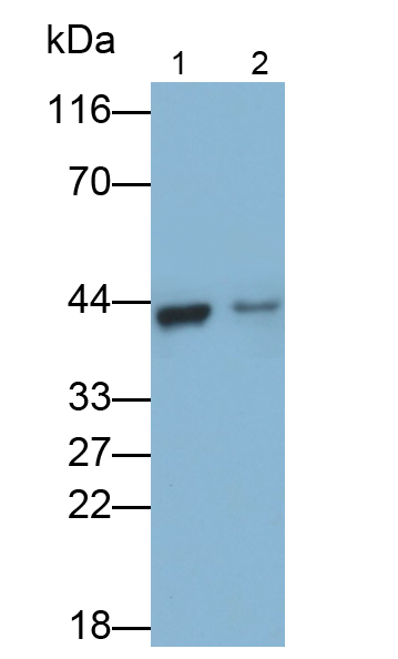 Polyclonal Antibody to Alpha-Methylacyl Coenzyme A Racemase (aMACR)