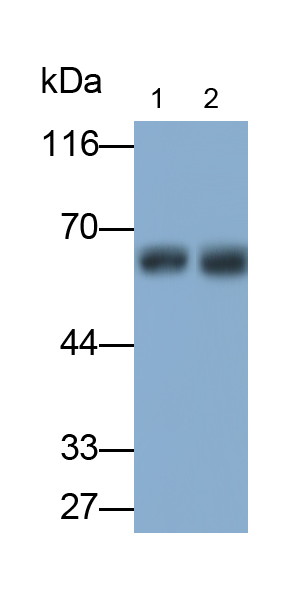 Polyclonal Antibody to Alkaline Phosphatase, Placental Like Protein 2 (ALPPL2)