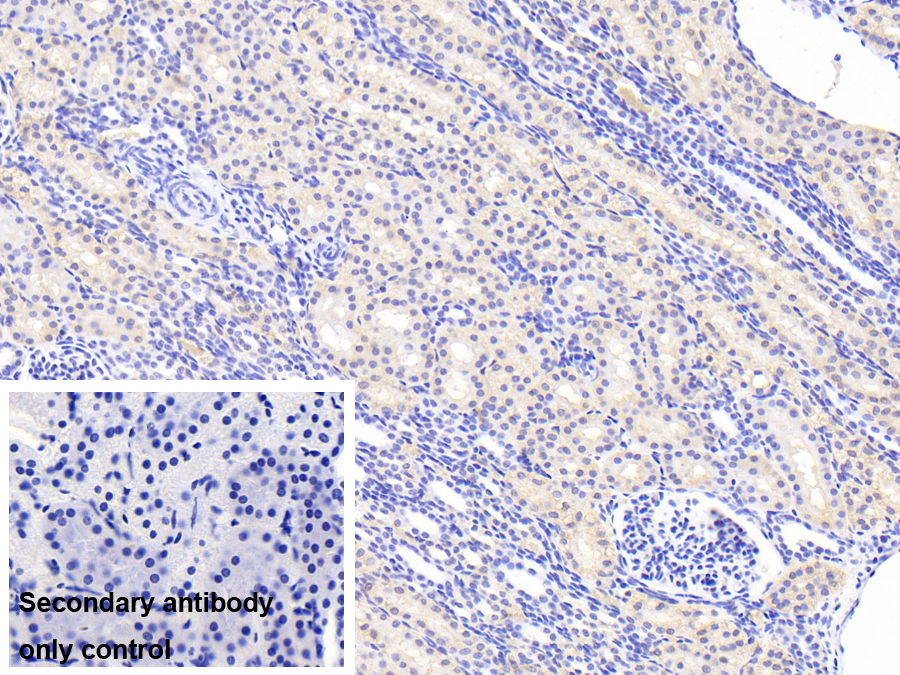 Polyclonal Antibody to Agmatine Ureohydrolase (AGMAT)