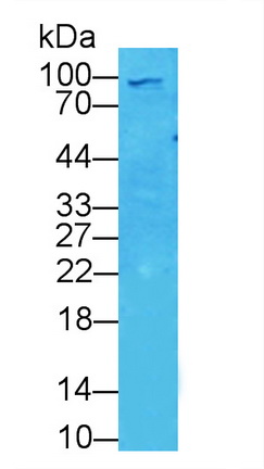 Polyclonal Antibody to Aconitase 1 (ACO1)