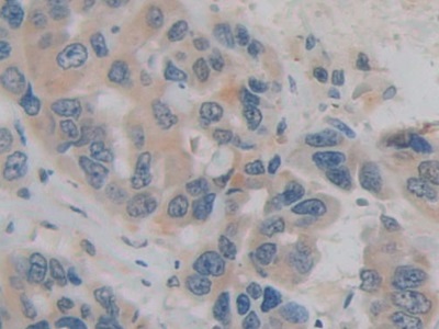 Polyclonal Antibody to H2A Histone Family, Member Y (H2AFY)