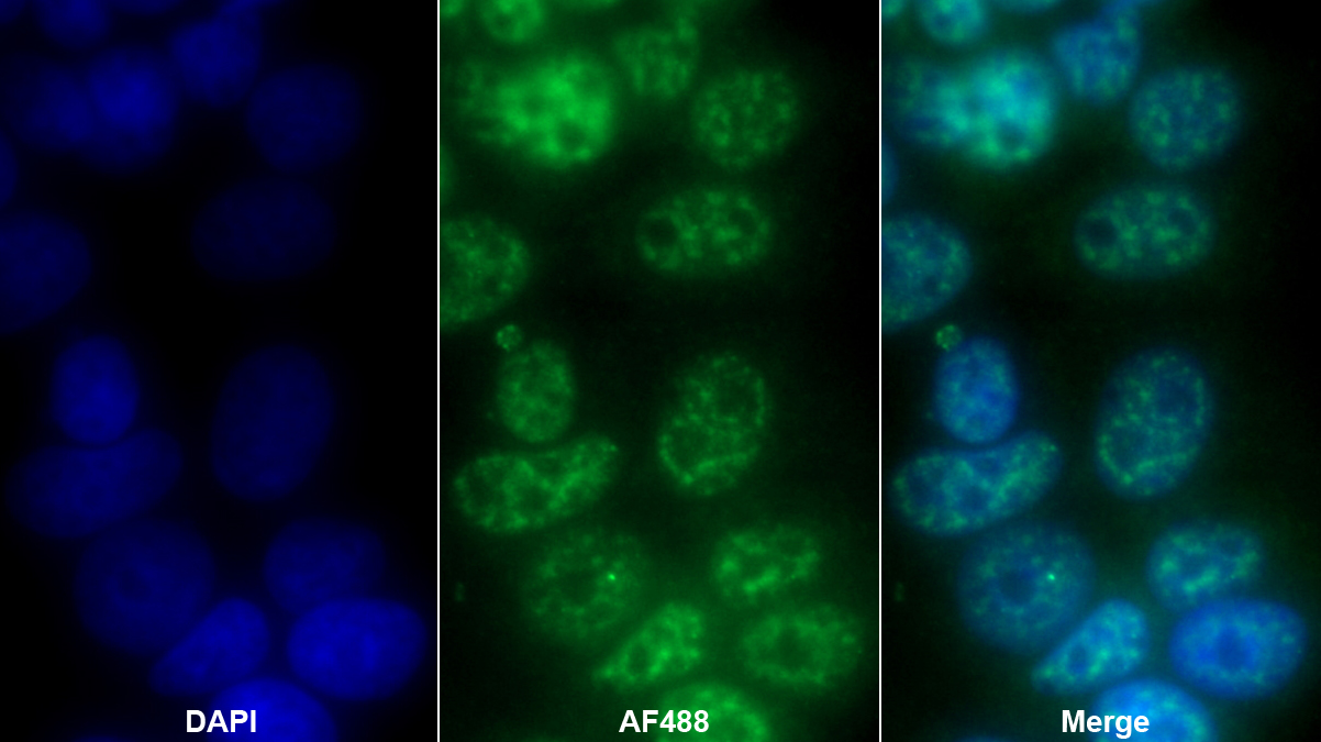 Polyclonal Antibody to HLA-B Associated Transcript 1 (BAT1)