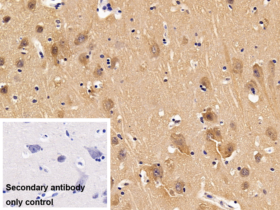 Polyclonal Antibody to Tyrosine 3/Tryptophan 5 Monooxygenase Activation Protein Zeta (YWHAz)