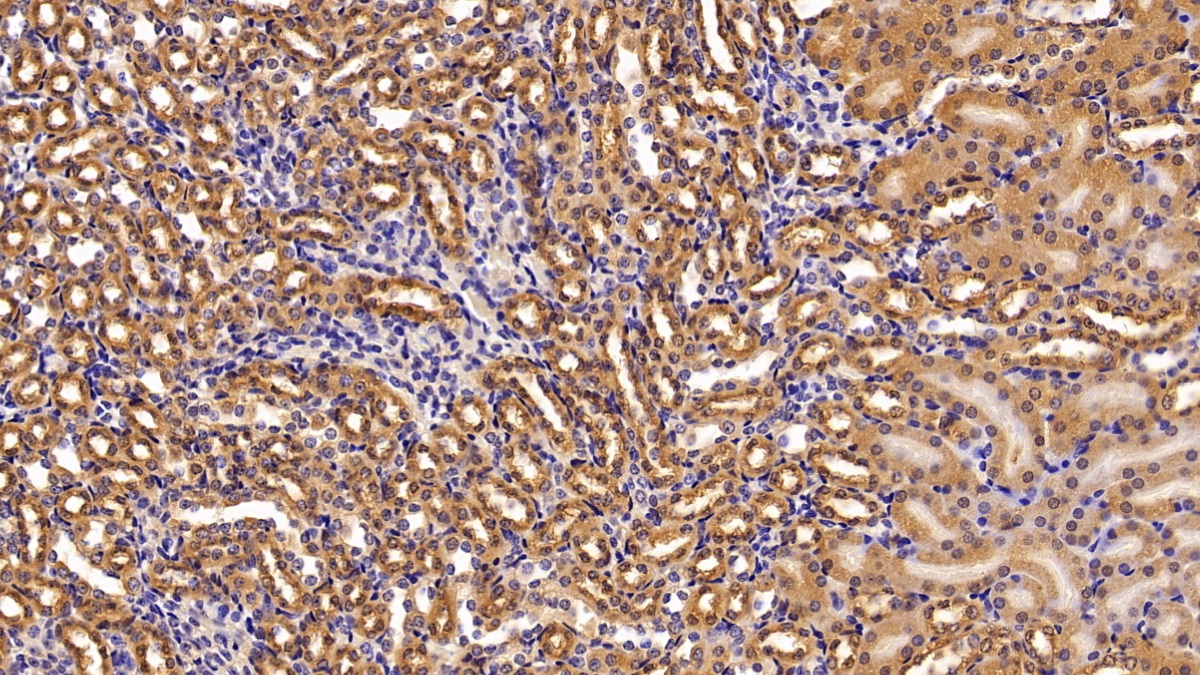 Polyclonal Antibody to Non Metastatic Cells 2, Protein NM23B Expressed In (NME2)