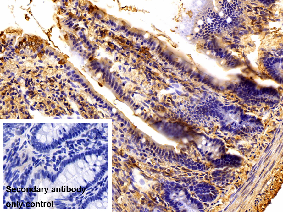 Polyclonal Antibody to Phosphoinositide-3-Kinase Catalytic Beta Polypeptide (PIK3Cb)