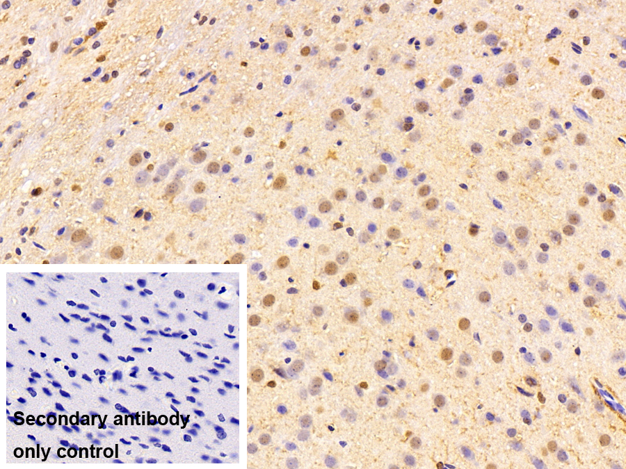 Polyclonal Antibody to Phosphoinositide-3-Kinase Catalytic Beta Polypeptide (PIK3Cb)