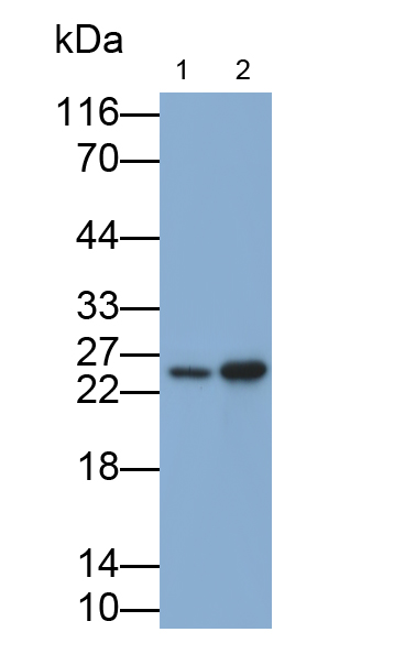 Polyclonal Antibody to Non Metastatic Cells 5, Protein NM23A Expressed In (NME5)