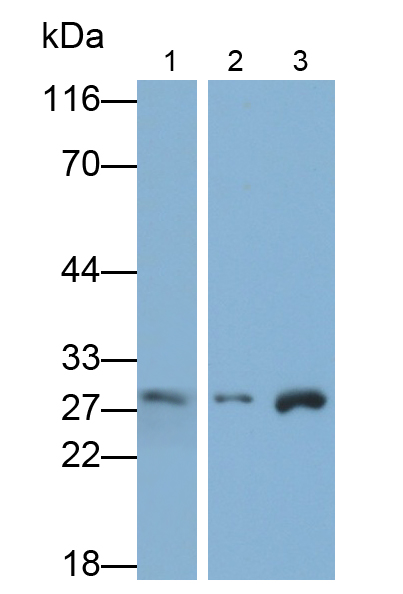 Polyclonal Antibody to Proteasome Subunit Beta Type 10 (PSMb10)