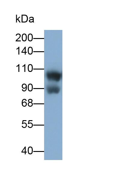 Polyclonal Antibody to GRB2 Associated Binding Protein 1 (GAB1)