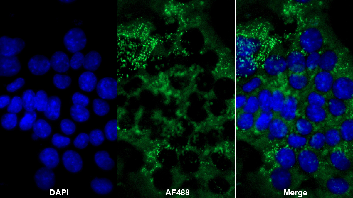 Polyclonal Antibody to Sprouty Homolog 1 (SPRY1)