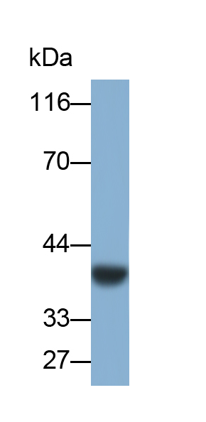 Polyclonal Antibody to PTEN Induced Putative Kinase 1 (PINK1)