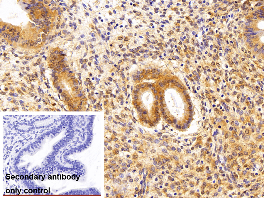 Polyclonal Antibody to Parkinson Disease Protein 7 (PARK7)