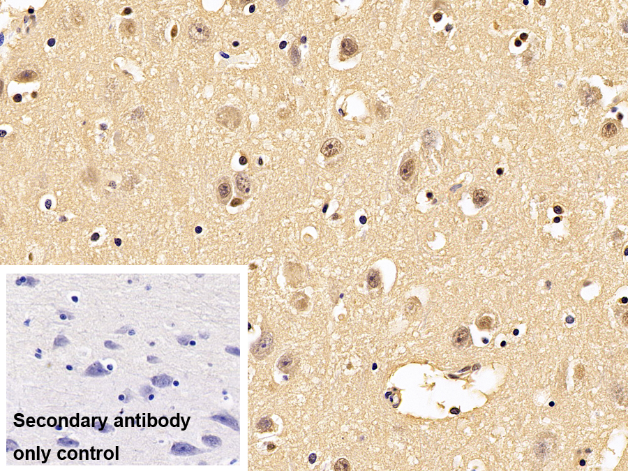 Polyclonal Antibody to Parkinson Disease Protein 7 (PARK7)