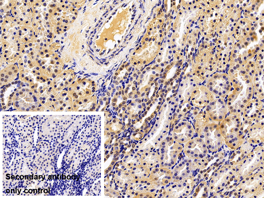 Polyclonal Antibody to Parkinson Disease Protein 7 (PARK7)