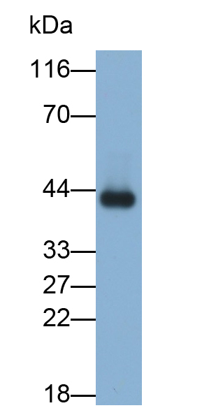 Polyclonal Antibody to Alpha-2-Glycoprotein 1, Zinc Binding (aZGP1)