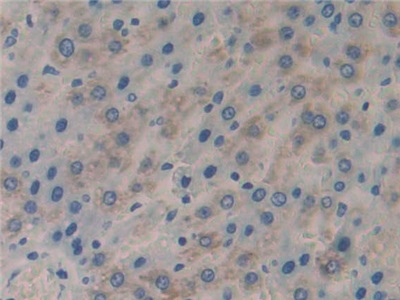 Polyclonal Antibody to CASP8 And FADD Like Apoptosis Regulator (CFLAR)