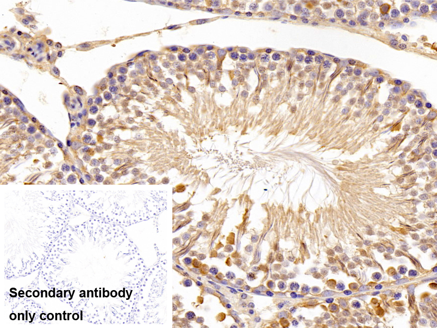 Polyclonal Antibody to FK506 Binding Protein Like Protein (FKBPL)