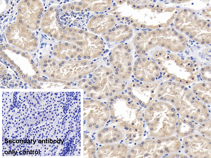 Polyclonal Antibody to Glial Cell Line Derived Neurotrophic Factor Receptor Alpha 1 (GFRa1)