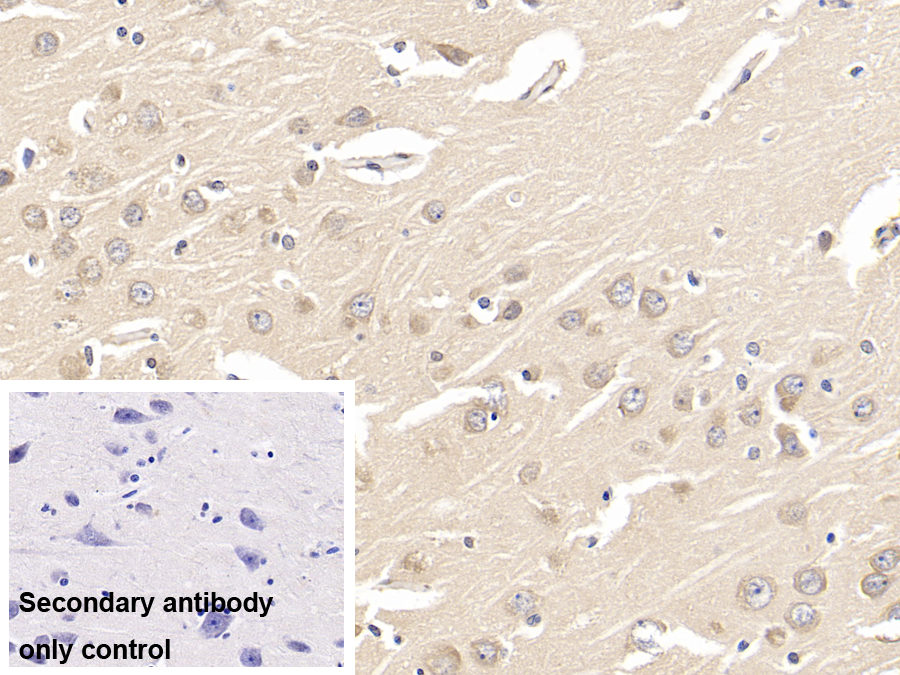 Polyclonal Antibody to Glial Cell Line Derived Neurotrophic Factor Receptor Alpha 1 (GFRa1)