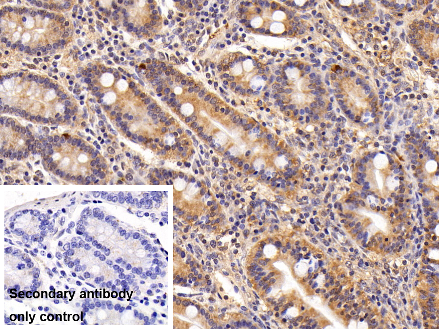 Polyclonal Antibody to Ubiquitin Cross Reactive Protein (UCRP)