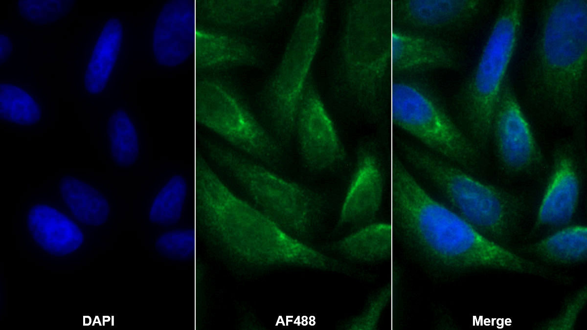 Polyclonal Antibody to Microtubule Associated Protein 1 Light Chain 3 Alpha (MAP1LC3a)