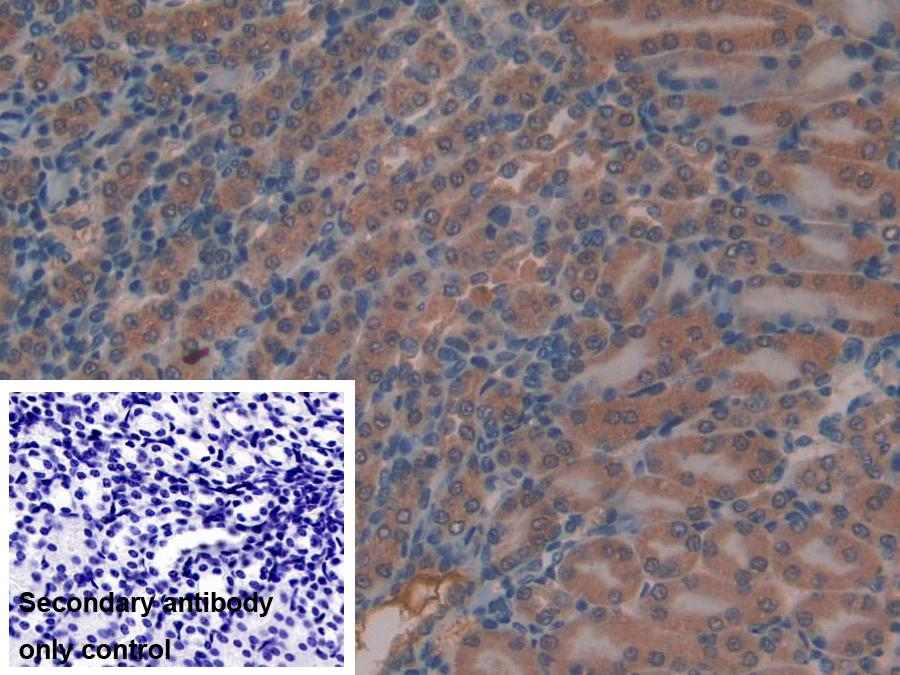 Polyclonal Antibody to Mindbomb Homolog 2 (MIB2)