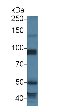 Polyclonal Antibody to USP6 N-Terminal Like Protein (USP6NL)